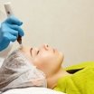 Dermapen