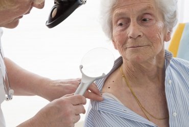 Dermatoscopia – diagnosticarea precoce a cancerului de piele