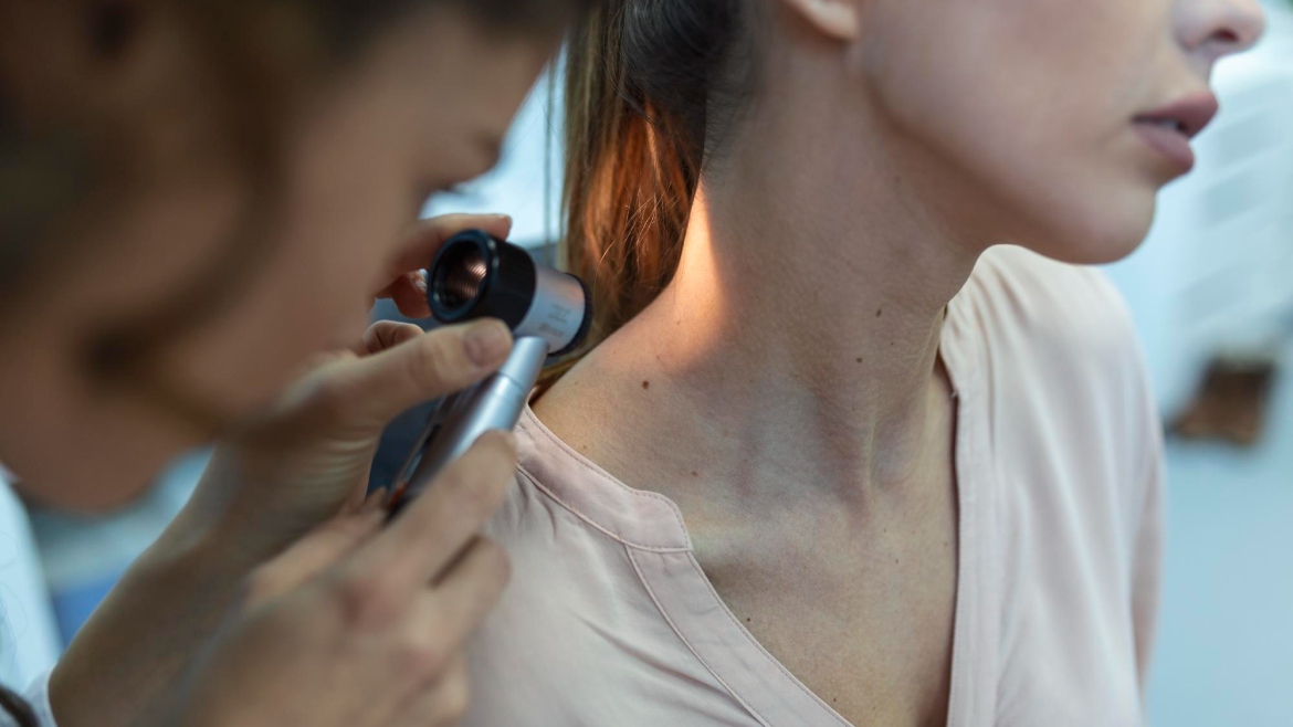 Discuții despre Dermatologie – Venorologie